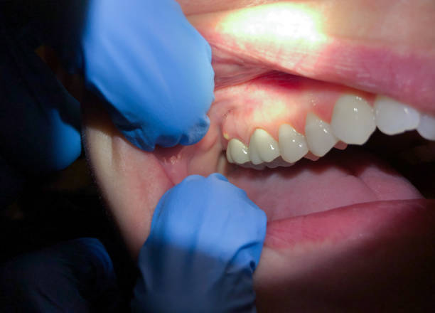 Best Dentist for Dental Trauma  in West Yellowstone, MT